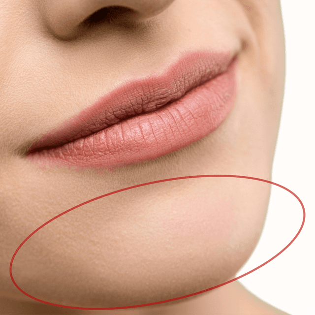 Prepaid Smooth Pass - Chin at Bareline Aesthetics in Brea, CA