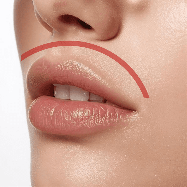 Prepaid Smooth Pass - Lip (Upper) at Bareline Aesthetics in Brea, CA