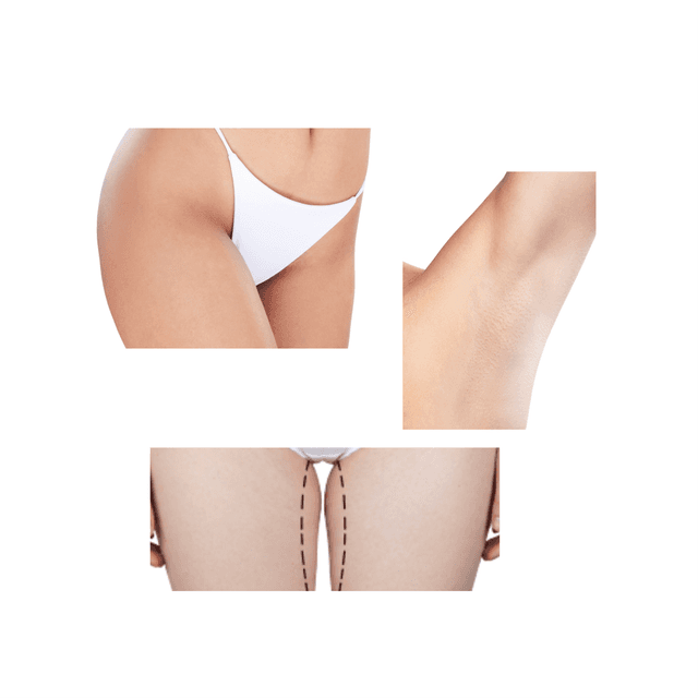 Brazilan + Inner Thigh + Underarm at Bareline Aesthetics in Brea, CA