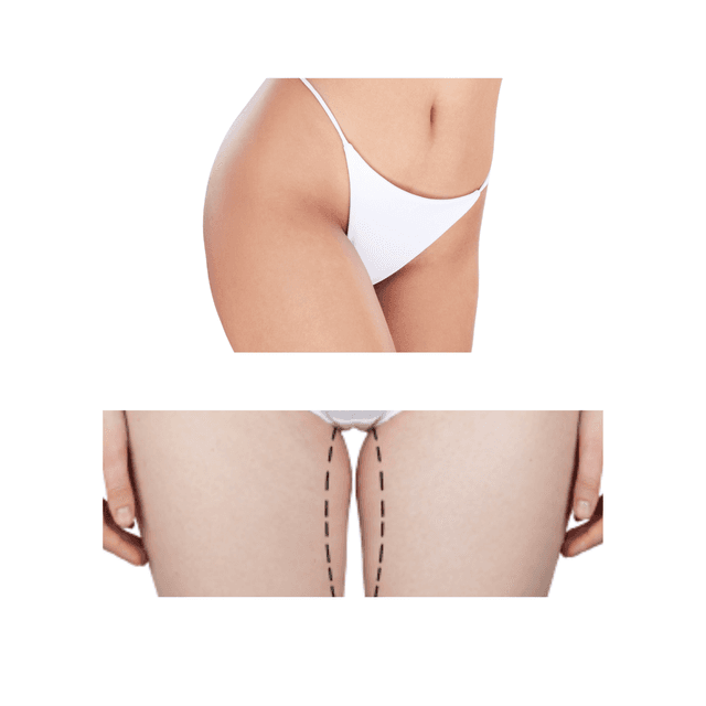 Brazilian + Inner Thigh at Bareline Aesthetics in Brea, CA