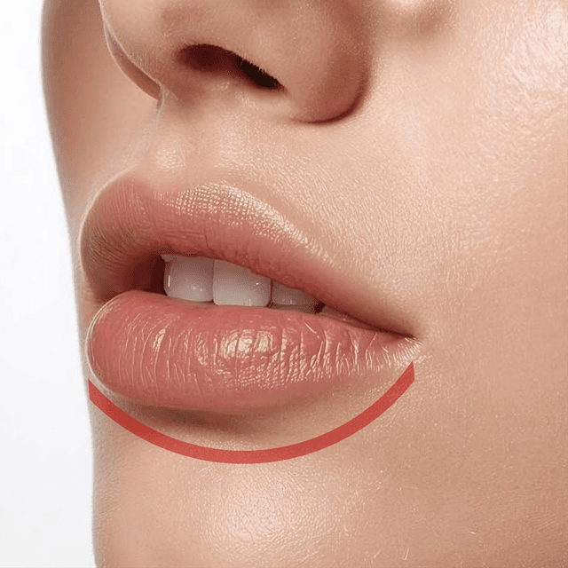 Prepaid Smooth Pass -  Lip (Lower) at Bareline Aesthetics in Brea, CA